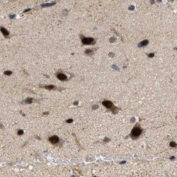 LARP6 Antibody, Novus Biologicals:Antibodies:Primary Antibodies