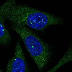 LARS Antibody, Novus Biologicals 0.1mL; Unlabeled:Antibodies, Polyclonal