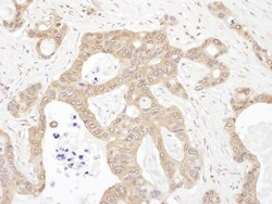 LARS Antibody, Novus Biologicals 0.1mg; Unlabeled:Antibodies, Polyclonal