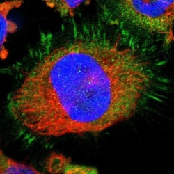LASP1 Antibody, Novus Biologicals 0.1mL; Unlabeled:Antibodies, Polyclonal