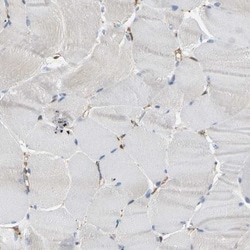 LASP1 Antibody, Novus Biologicals 0.1mL; Unlabeled:Antibodies, Polyclonal