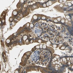 LASP1 Antibody, Novus Biologicals 0.1mL; Unlabeled:Antibodies, Polyclonal
