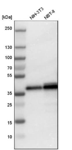 LASP1 Antibody, Novus Biologicals 0.1mL; Unlabeled:Antibodies, Polyclonal