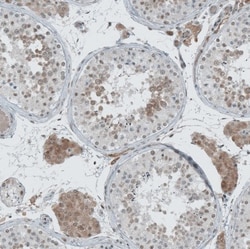 LASS3 Antibody, Novus Biologicals:Antibodies:Primary Antibodies