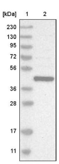 LASS3 Antibody, Novus Biologicals 0.1mL; Unlabeled:Antibodies, Polyclonal