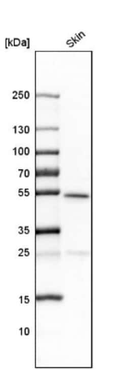 LASS3 Antibody, Novus Biologicals:Antibodies:Primary Antibodies