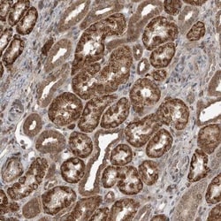 LATS1 Antibody, Novus Biologicals 0.1mL; Unlabeled:Antibodies, Polyclonal
