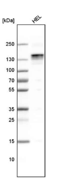 LATS1 Antibody, Novus Biologicals 0.1mL; Unlabeled:Antibodies, Polyclonal