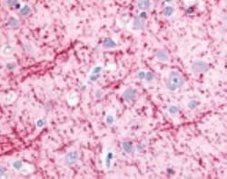 LC3A Antibody - BSA Free, Novus Biologicals 0.025mL; Unlabeled:Antibodies,