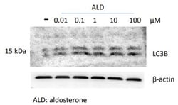 LC3B Antibody - BSA Free, Novus Biologicals 0.025mL; Unlabeled:Antibodies,