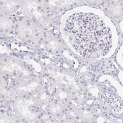 LCE6A Antibody, Novus Biologicals:Antibodies:Primary Antibodies