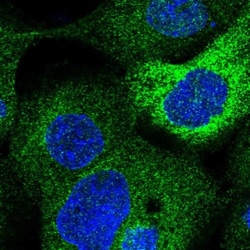 LCLAT1 Antibody, Novus Biologicals:Antibodies:Primary Antibodies