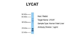 LCLAT1 Antibody, Novus Biologicals 0.05mg; Unlabeled:Antibodies, Polyclonal