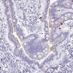 LCN15 Antibody, Novus Biologicals:Antibodies:Primary Antibodies