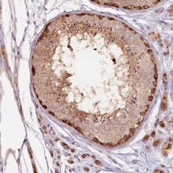 LDHD Antibody, Novus Biologicals 0.1mL; Unlabeled:Antibodies, Polyclonal