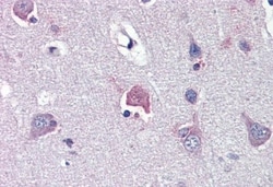 LDOC1 Antibody, Novus Biologicals 0.05mg; Unlabeled:Antibodies, Polyclonal