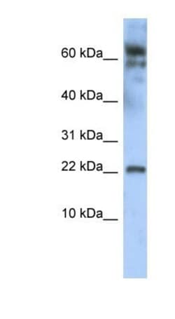 LDOC1 Antibody, Novus Biologicals 0.05mg; Unlabeled:Antibodies, Polyclonal