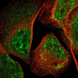 LDOC1L Antibody, Novus Biologicals 25 &mu;L; Unlabeled:Antibodies, Polyclonal
