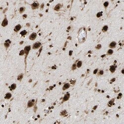LEDGF Antibody, Novus Biologicals 25 &mu;L; Unlabeled:Antibodies, Polyclonal