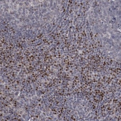 LEF1 Antibody, Novus Biologicals 0.1mL; Unlabeled:Antibodies, Polyclonal