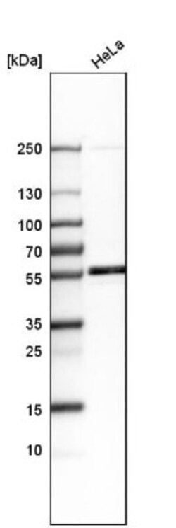 LEMD2 Antibody, Novus Biologicals 25ul | Buy Online | Novus Biologicals | Fisher Scientific