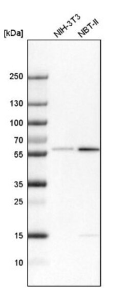 LEMD2 Antibody, Novus Biologicals 25ul | Buy Online | Novus Biologicals | Fisher Scientific