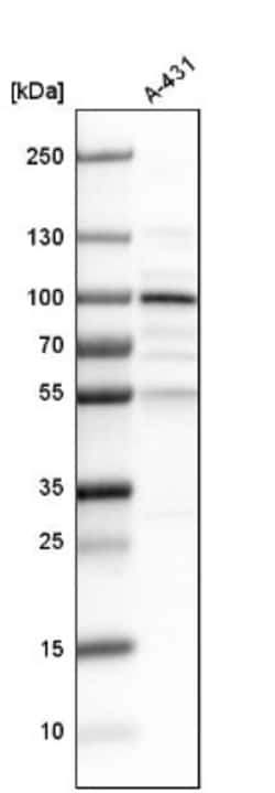LEPREL1 Antibody, Novus Biologicals:Antibodies:Primary Antibodies