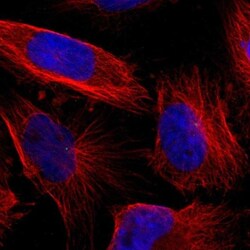 LGI2 Antibody, Novus Biologicals 0.1mL; Unlabeled:Antibodies, Polyclonal