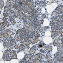 LGI2 Antibody, Novus Biologicals 0.1mL; Unlabeled:Antibodies, Polyclonal
