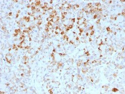 LH beta Antibody (LHb/1214), Novus Biologicals 0.2mg; Unlabeled:Antibodies,