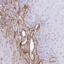 LHFP Antibody, Novus Biologicals 0.1mL; Unlabeled:Antibodies, Polyclonal