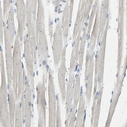 LHPP Antibody, Novus Biologicals 25 &mu;L; Unlabeled:Antibodies, Polyclonal