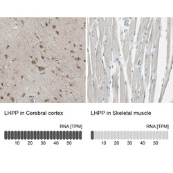 LHPP Antibody, Novus Biologicals 25 &mu;L; Unlabeled:Antibodies, Polyclonal