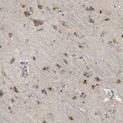 LHPP Antibody, Novus Biologicals 25 &mu;L; Unlabeled:Antibodies, Polyclonal