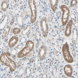 LHPP Antibody, Novus Biologicals 25 &mu;L; Unlabeled:Antibodies, Polyclonal
