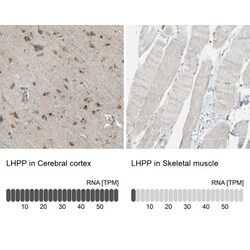 LHPP Antibody, Novus Biologicals 25 &mu;L; Unlabeled:Antibodies, Polyclonal