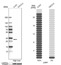 LHPP Antibody, Novus Biologicals 25 &mu;L; Unlabeled:Antibodies, Polyclonal