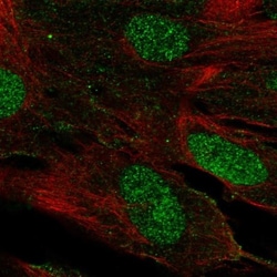 LHX9 Antibody, Novus Biologicals:Antibodies:Primary Antibodies