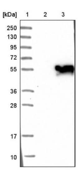 LHX9 Antibody, Novus Biologicals:Antibodies:Primary Antibodies