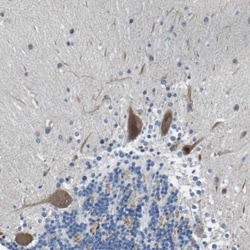 LIAS Antibody, Novus Biologicals 0.1mL; Unlabeled:Antibodies, Polyclonal