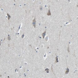 LIAS Antibody, Novus Biologicals 0.1mL; Unlabeled:Antibodies, Polyclonal