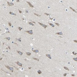 LIAS Antibody, Novus Biologicals 0.1mL; Unlabeled:Antibodies, Polyclonal