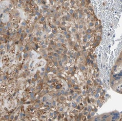 LIM kinase 2 Antibody, Novus Biologicals:Antibodies:Primary Antibodies