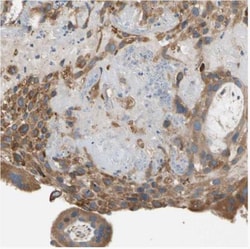 LIM kinase 2 Antibody, Novus Biologicals:Antibodies:Primary Antibodies