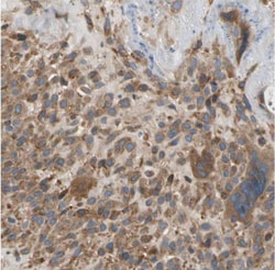 LIM kinase 2 Antibody, Novus Biologicals:Antibodies:Primary Antibodies