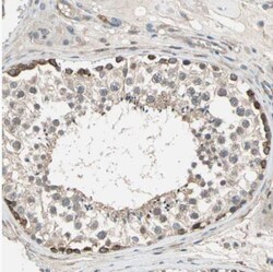 LIM kinase 2 Antibody, Novus Biologicals:Antibodies:Primary Antibodies