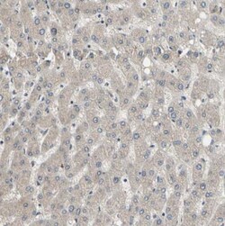 LIM kinase 2 Antibody, Novus Biologicals:Antibodies:Primary Antibodies
