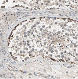 LIM kinase 2 Antibody, Novus Biologicals:Antibodies:Primary Antibodies