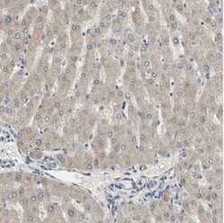 LIM kinase 2 Antibody, Novus Biologicals:Antibodies:Primary Antibodies