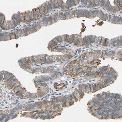 LIM kinase 2 Antibody, Novus Biologicals:Antibodies:Primary Antibodies